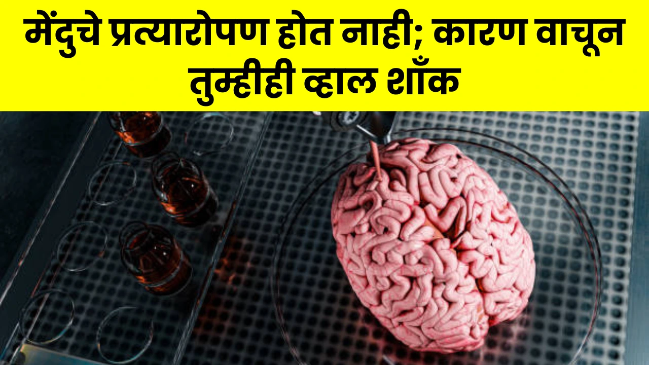 Brain Transplant